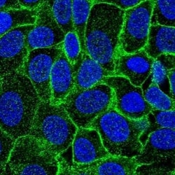 ErbB2/Her2 Antibody, Novus Biologicals:Antibodies:Primary Antibodies