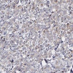 ErbB2/Her2 Antibody, Novus Biologicals:Antibodies:Primary Antibodies