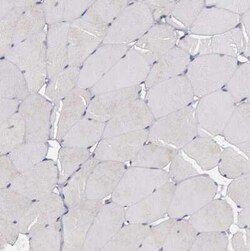 ErbB2/Her2 Antibody, Novus Biologicals:Antibodies:Primary Antibodies