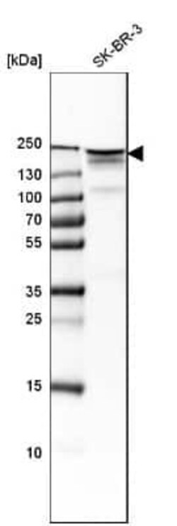 ErbB2/Her2 Antibody, Novus Biologicals:Antibodies:Primary Antibodies