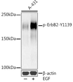 ErbB2/Her2 Rabbit anti-Human, Clone: 7N1S0, Novus Biologicals:Antibodies:Primary