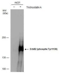 ErbB2/Her2, p Tyr1139 Antibody, Novus Biologicals 100 &mu;g; Unconjugated:Antibodies,