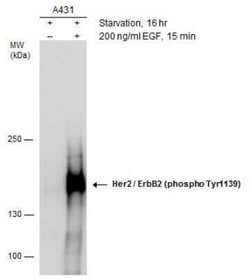 ErbB2/Her2, p Tyr1139 Antibody, Novus Biologicals 100 &mu;g; Unconjugated:Antibodies,