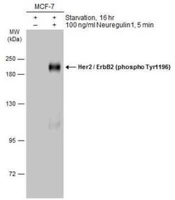 ErbB2/Her2, p Tyr1196 Antibody, Novus Biologicals 100 &mu;g | Buy Online | Novus Biologicals | Fisher Scientific