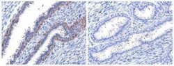 ErbB2/Her2, p Tyr1222, p Tyr1221 Antibody, Novus Biologicals 100 &mu;g | Buy Online | Novus Biologicals | Fisher Scientific