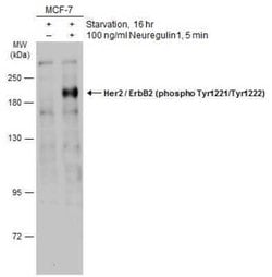 ErbB2/Her2, p Tyr1222, p Tyr1221 Antibody, Novus Biologicals 100 &mu;g | Buy Online | Novus Biologicals | Fisher Scientific
