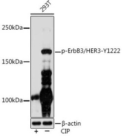 ErbB3/Her3 Rabbit anti-Human, Clone: 5Z1F0, Novus Biologicals:Antibodies:Primary