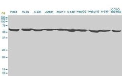 Erythropoietin R Antibody (3D10), Novus Biologicals 0.1 mg | Buy Online | Novus Biologicals | Fisher Scientific
