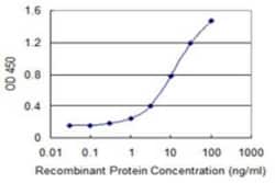 Eukaryotic translation initiation factor 5B Antibody (3F9), Novus Biologicals 0.1 mg | Buy Online | Novus Biologicals | Fisher Scientific