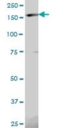 Eukaryotic translation initiation factor 5B Antibody, Novus Biologicals 0.05 mg | Buy Online | Novus Biologicals | Fisher Scientific