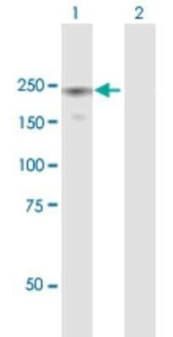 Eukaryotic translation initiation factor 5B Antibody, Novus Biologicals 0.05 mg | Buy Online | Novus Biologicals | Fisher Scientific