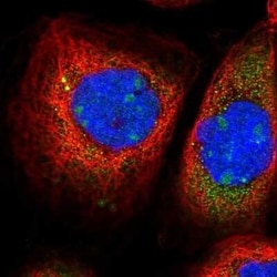 Exosome Component 9 Antibody, Novus Biologicals 0.1 mL | Buy Online | Novus Biologicals | Fisher Scientific