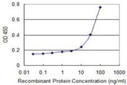 Exosome component 1 Antibody (2E9), Novus Biologicals 0.1 mg, Unconjugated:Antibodies,