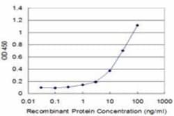 Exosome component 10 Antibody (1E6), Novus Biologicals 0.1 mg | Buy Online | Novus Biologicals | Fisher Scientific