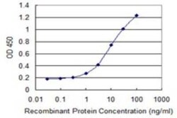Exosome component 4 Antibody (4F10), Novus Biologicals 0.1 mg | Buy Online | Novus Biologicals | Fisher Scientific