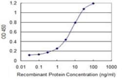 Exosome component 4 Antibody (4F9), Novus Biologicals 0.1 mg; Unconjugated:Antibodies,