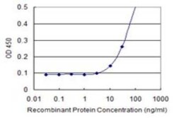 Exosome component 5 Antibody (1E11), Novus Biologicals 0.1 mg | Buy Online | Novus Biologicals | Fisher Scientific