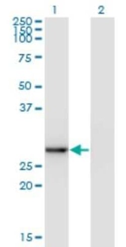 Exosome component 5 Antibody (1E11), Novus Biologicals 0.1 mg | Buy Online | Novus Biologicals | Fisher Scientific
