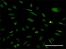 Exosome component 5 Antibody (2E7), Novus Biologicals 0.1 mg | Buy Online | Novus Biologicals | Fisher Scientific
