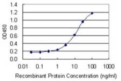 Exosome component 5 Antibody (2E7), Novus Biologicals 0.1 mg | Buy Online | Novus Biologicals | Fisher Scientific