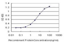 Exosome component 5 Antibody (6G11), Novus Biologicals 0.1 mg | Buy Online | Novus Biologicals | Fisher Scientific
