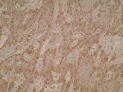 Exosome component 5 Antibody (V80P1C10 C) - BSA Free, Novus Biologicals:Antibodies:Primary