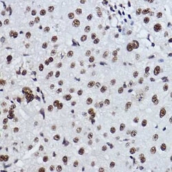 Exosome component 7 Rabbit anti-Human, Clone: 0B8G6, Novus Biologicals