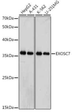 Exosome component 7 Rabbit anti-Human, Clone: 0B8G6, Novus Biologicals