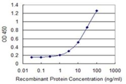 Exosome component 7 Antibody (2F10), Novus Biologicals 0.1 mg | Buy Online | Novus Biologicals | Fisher Scientific