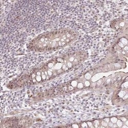 Exosome component 7 Antibody, Novus Biologicals 0.1 mL; Unconjugated:Antibodies,