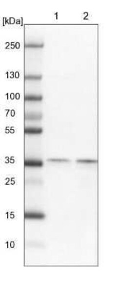 Exosome component 7 Antibody, Novus Biologicals 0.1 mL; Unconjugated:Antibodies,