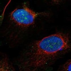 Exosome component 8 Rabbit anti-Human, Polyclonal, Novus Biologicals 100