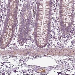 F-Spondin/SPON1 Antibody, Novus Biologicals 100 &mu;g; Unconjugated:Antibodies,