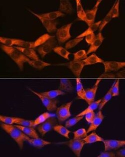 FABP1/L-FABP Rabbit anti-Human, Mouse, Rat, Clone: 8Q8S10, Novus Biologicals:Antibodies:Primary