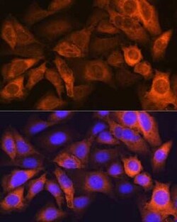 FABP1/L-FABP Rabbit anti-Human, Mouse, Rat, Clone: 8Q8S10, Novus Biologicals:Antibodies:Primary