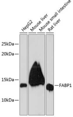 FABP1/L-FABP Rabbit anti-Human, Mouse, Rat, Clone: 8Q8S10, Novus Biologicals:Antibodies:Primary