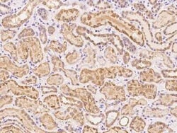 FABP12 Antibody, Novus Biologicals:Antibodies:Primary Antibodies