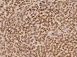 FABP12 Antibody, Novus Biologicals:Antibodies:Primary Antibodies