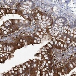 FABP2/I-FABP Antibody, Novus Biologicals:Antibodies:Primary Antibodies