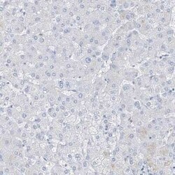 FABP2/I-FABP Antibody, Novus Biologicals:Antibodies:Primary Antibodies
