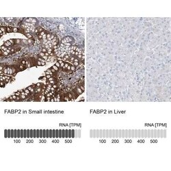 FABP2/I-FABP Antibody, Novus Biologicals:Antibodies:Primary Antibodies