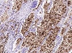 FABP4/A-FABP Rabbit anti-Human, Clone: 1, Novus Biologicals 100 &mu;g;