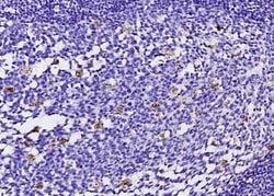 FABP4/A-FABP Rabbit anti-Human, Clone: 1, Novus Biologicals 100 &mu;g;