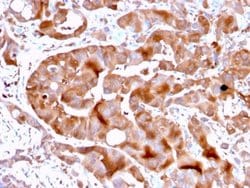FABP5/E-FABP, Mouse anti-Human, Clone: FABP5/3750, Novus Biologicals:Antibodies:Primary