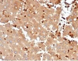 FABP5/E-FABP Rabbit anti-Human, Clone: FABP5/6353R, Novus Biologicals:Antibodies:Primary