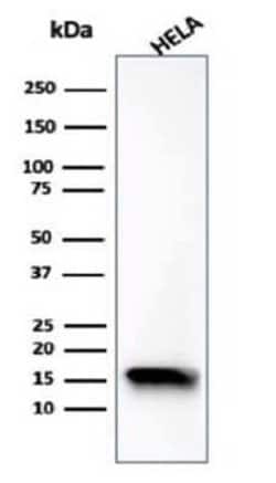FABP5/E-FABP Rabbit anti-Human, Clone: FABP5/6353R, Novus Biologicals:Antibodies:Primary
