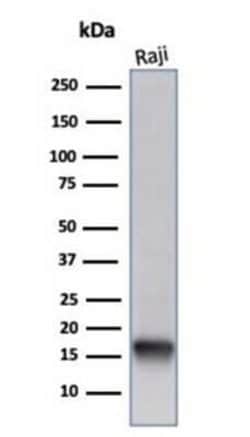 FABP5/E-FABP Rabbit anti-Human, Clone: FABP5/6353R, Novus Biologicals:Antibodies:Primary