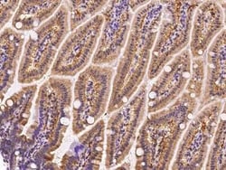 FABP6 Antibody, Novus Biologicals:Antibodies:Primary Antibodies