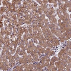 FADS1 Antibody, Novus Biologicals 25 &mu;L | Buy Online | Novus Biologicals | Fisher Scientific