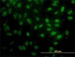 FAF1 Antibody (1A10), Novus Biologicals 0.1 mg | Buy Online | Novus Biologicals | Fisher Scientific